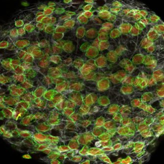 Petit groupe de cellules souches nerveuses isolées chez la souris et cultivées in vitro observées au microscope confocal. (LaminB1 en vert, Sox2 en rouge)